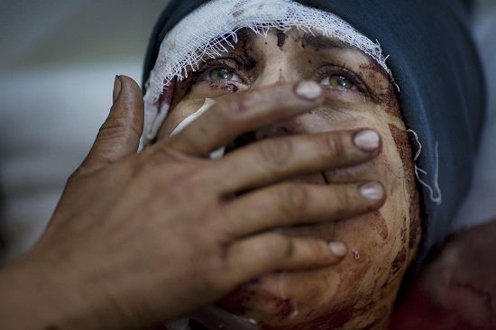 一般性新闻类单幅一等奖《阿依达的哭声》：在叙利亚军队的炮击中，阿依达的房屋被炸毁，丈夫和两个孩子受重伤。(阿根廷摄影师Rodrigo Abd拍摄)