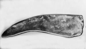 世界上最早的手术刀——砭镰