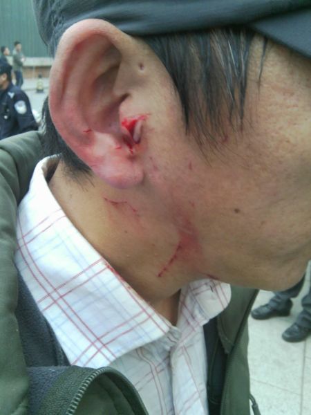 798物业安保人员杨某近日耳部病情加重，左耳出现失聪，