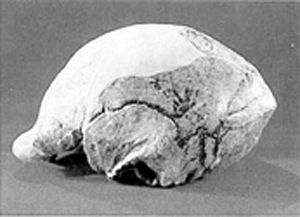 北京猿人头盖骨化石